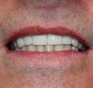 smile7_after