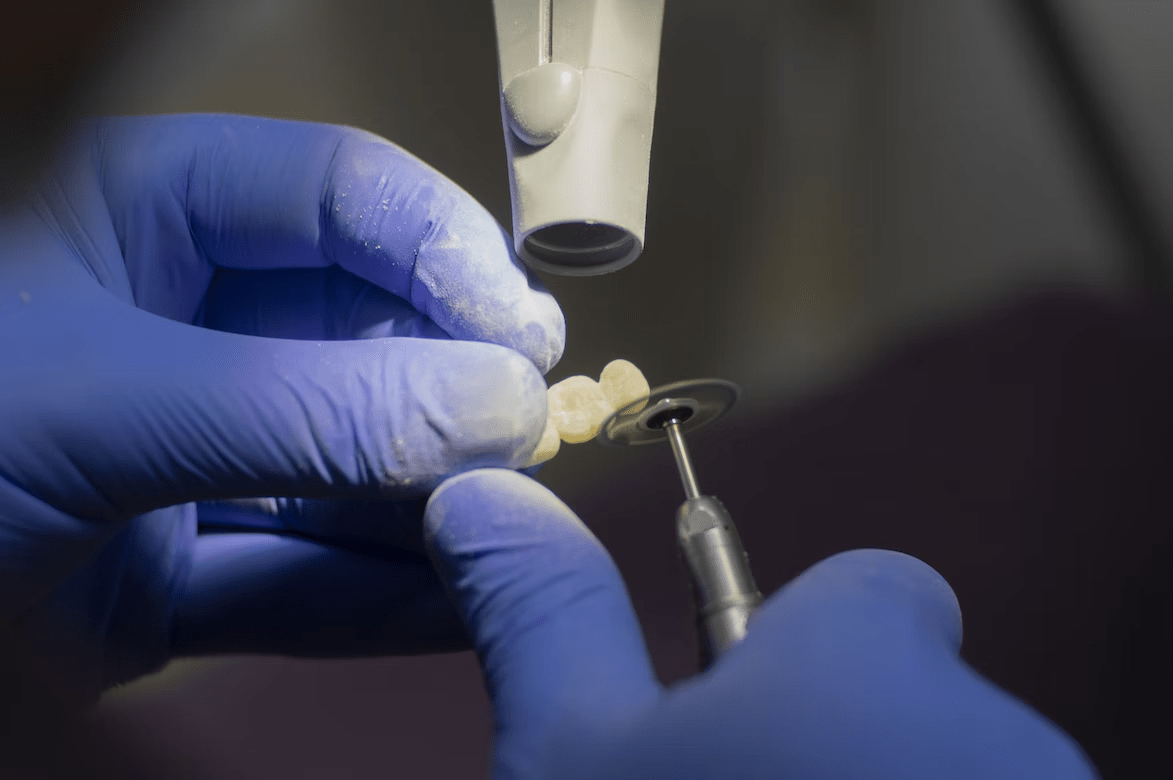 veneer being carved by a dental technician by using specialized tools