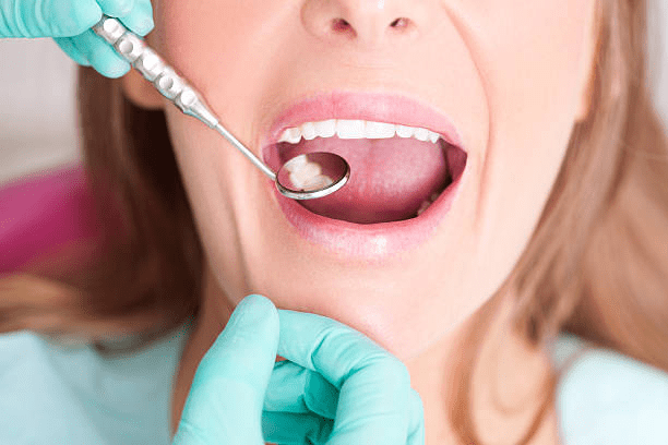 photo of a woman's mouth during a dental check-up through a dental mirror